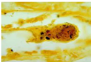 Gambar 2.1 Bakteri Leptospira
