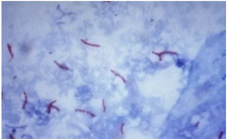 Gambar 2.1 Mycobacterium tuberculosis pada pewarnaan tahan asam