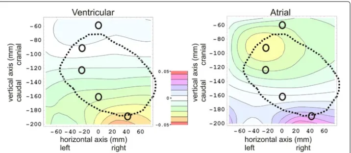Figure 3 Results of the ex-vivo post-mortembelow the thoracic skin. The positions of five electrodes (the definition of calibration measurements, showing a ventricular’fingerprint’ plot at the left, an atrial ’fingerprint’ plot at the right, and a color sc