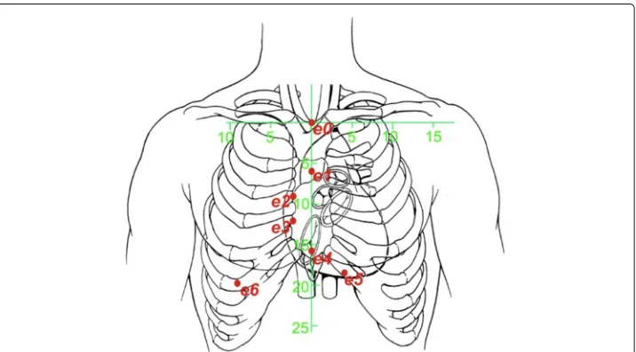 Figure 1 Schematic rendering the electrode positions with respect to the anatomy of the human