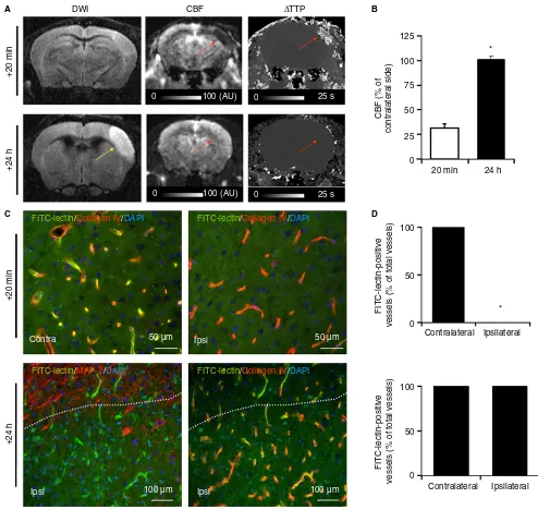 Fig. 1. Lack of secondary cerebral blood ﬂow (CBF) reduction after thrombin-induced stroke and reperfusion in mice