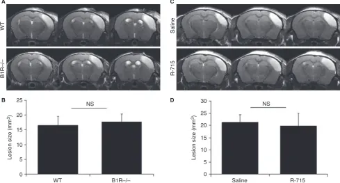 Fig. 2. Lack of secondary cerebral blood ﬂow (CBF) reduction after thrombin-induced stroke and reperfusion in non-human primates