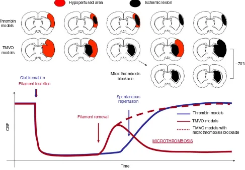 Fig. 4. Working model of cerebral blood ﬂow (CBF) and infarct development in thrombin and transient mechanical vascular occlusion(TMVO) models.