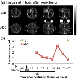 Fig. (4). Transient MCAO: (a) cerebral blood flow (CBF, upper row) and apparent diffusion coefficient (ADC, lower row) maps of an animal an ADC of 0 to 0.3 x 10subjected to a 60-min transient occlusion