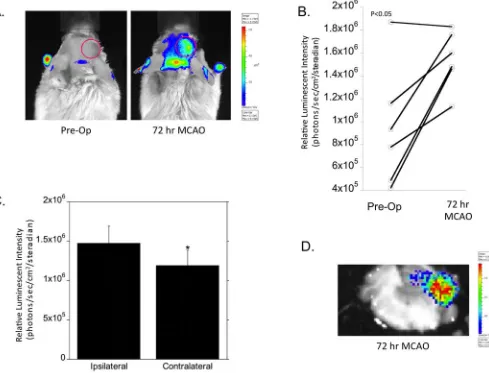 Figure 2. Non-invasive imaging of NFAT5 response following MCAO in NFAT5-Luciferase mice(A) Representative images of real time NFAT5 expression was determined pre-operativelyand 72 hours following MCAO surgery by intraperitoneal injection with substrate lu