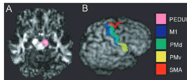 Fig. 1 Definition of seed points and cortical motor areas for tractography. (right hemisphere, as defined on the same individual, shown on the individual’s volume-rendered Tthe right cerebral peduncle on theA) Seed points for tractography shown on the cros
