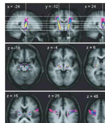 Fig. 4 Trajectory variability maps for the peduncle/PMv connections shown on representative sections of the average of the Txstructural