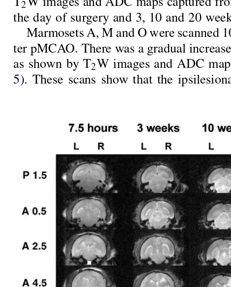 Fig. 5. Complete set of ADC maps from marmoset O at stereotaxic levelsA 14.5–P1.5 obtained 7.5 h, 3, 10 and 20 weeks after pMCAO