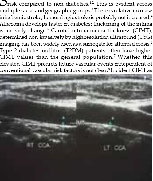 Fig. 1 : Carotid intima-media thickness measurement at the level of common carotid artery