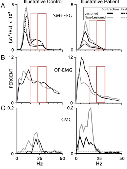 Fig. 1. Power spectral density of SM1-EEG, relative OP-EMG and CMC: representativedata