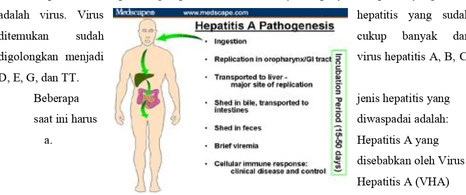Gambar 8. Hepatitis A