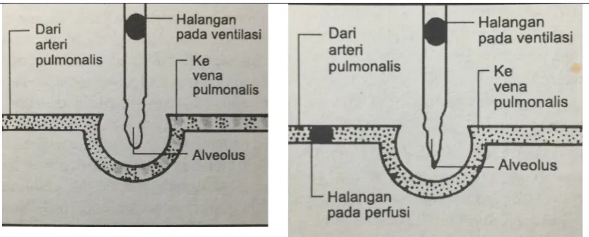 Gambar 4. Perfusi yang tidak adekuat