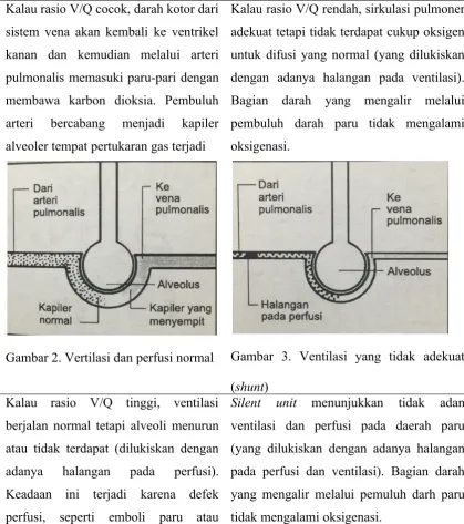 Gambar  3.  Ventilasi  yang  tidak  adekuat