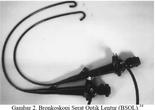 Gambar 2. Bronkoskopi Serat Optik Lentur (BSOL).34 