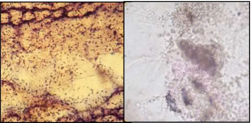 Gambar 9. a) Penicillium digitatum, b) Azotobacter sp. 