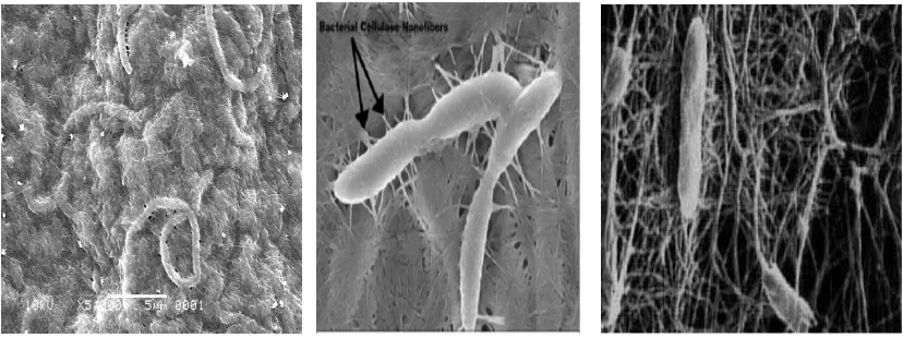 Gambar 2.6 selulosa bakteri  