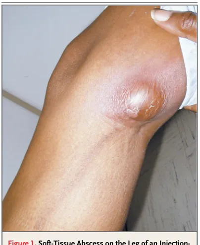 Figure 1. Soft-Tissue Abscess on the Leg of an Injection-