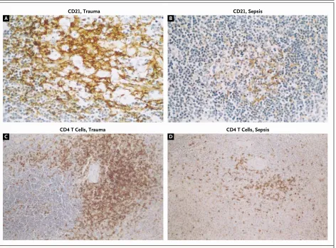 Figure 3. Immunohistochemical Staining for Follicular Dendritic Cells (CD21) (Top Panels, ¬600) and CD4 T Cells (Bottom Panels, ¬600) in Spleens from Patients with Trauma (Panels A and C) or Patients Who Died of Sepsis (Panels B and D).The patients with se