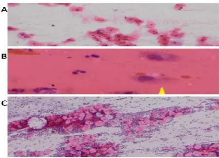 Gambar 1. Gambaran hasil pemeriksaan Pap smearyaitu normal smear (A), B. normal atropicsmear (B), dan NILM (C)