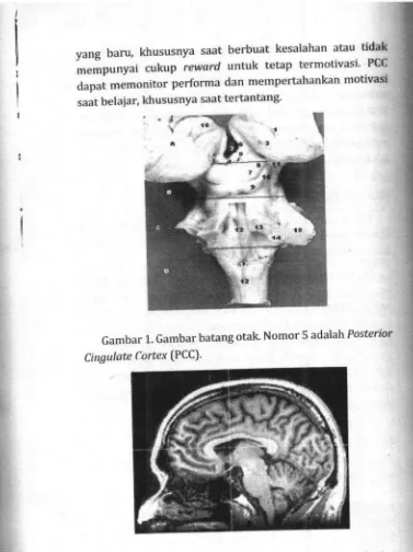 Gambar 1. Gambar batang otak Nomor 5 adalah Posterior