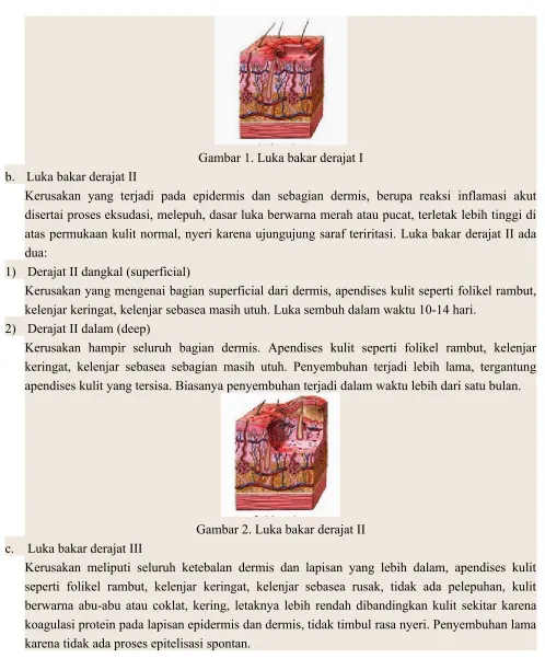Gambar 1. Luka bakar derajat I