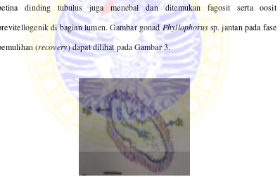Gambar 3. Histologi Gonad Phyllophorus sp. Jantan Fase Pemulihan (Recovery)(Nisa, 2012) 