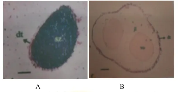 Gambar 6. Histologi Gonad Phyllophorus sp. Jantan (A) dan Betina (B) pada Fase 