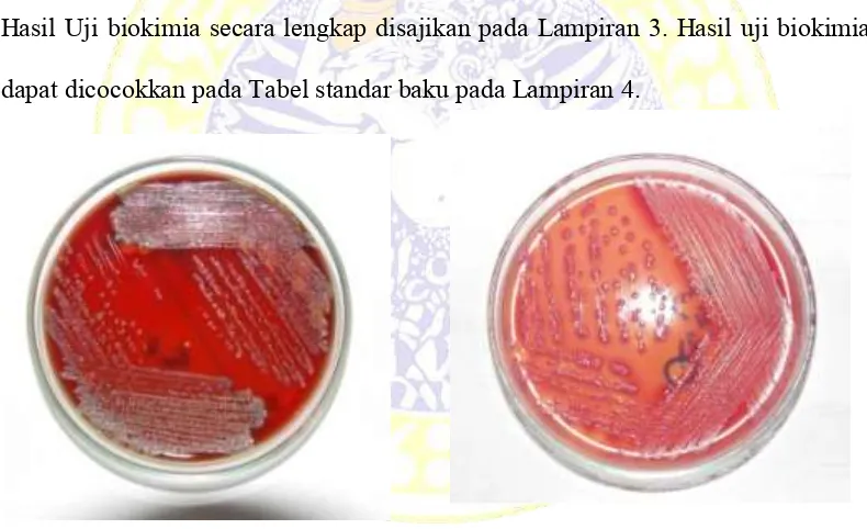 Gambar 4.2 Koloni Bakteri gram negatif pada media McConcey Agar 