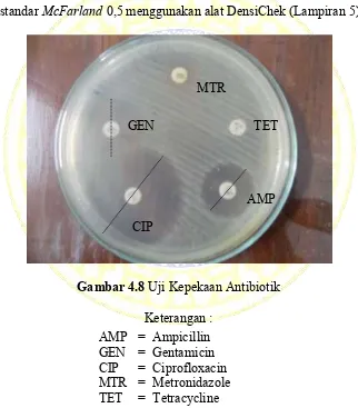 Gambar 4.8 Uji Kepekaan Antibiotik 