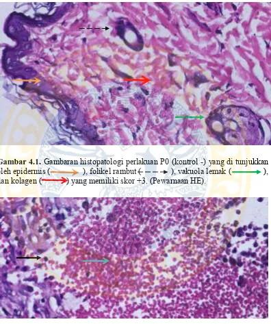 Gambar 4.1. Gambaran histopatologi perlakuan P0 (kontrol -) yang di tunjukkan oleh epidermis (               ), folikel rambut (              ), vakuola lemak (               ), 