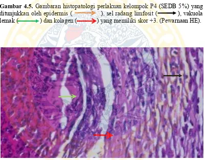 Gambar 4.5.ditunjukkan oleh epidermis (              ), sel radang limfosit (          ), vakuola 