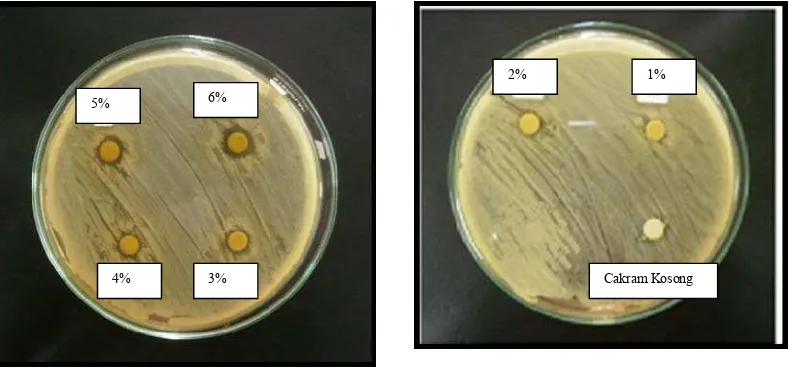Gambar 9.  Hasil uji efektifitas ekstrak daun sirih hijau pada konsentrasi  6%, 5%, 4%, 3%, 2%, 1%,                 Kontrol (-) terhadap Streptococcus mutans 