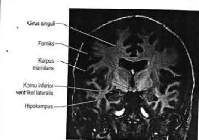 Gambar  16.14  eenampang  transversal  melewati  hipokampus  dan