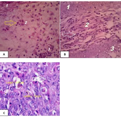 Gambar 4.1.   Lamina propria vagina mencit kontrol (A) tampak normal (tanda panah kuning), perlakuan (B) ada infiltrasi sel radang (tanda panah putih) dan perlakuan (C) ada bentukan takizoit T