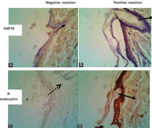Figure 2: Number of the keratinocytes that expressed heat shock protein 70 (HSP70) (A) and the number of the keratinocytes that expressed ß-endorphin (B) in the control group and the treatment group of wet cupping therapy
