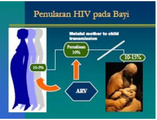 Gambar 1. Penularan HIV dari ibu ke bayi 