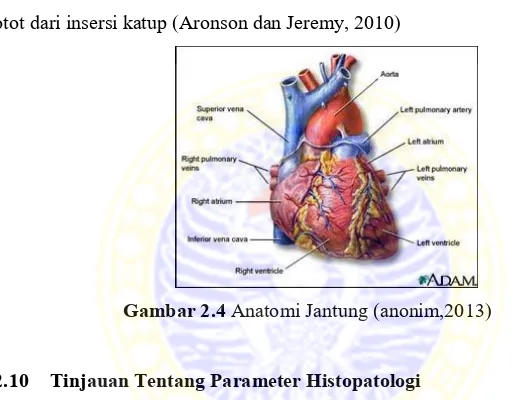 Gambar 2.4 Anatomi Jantung (anonim,2013) 