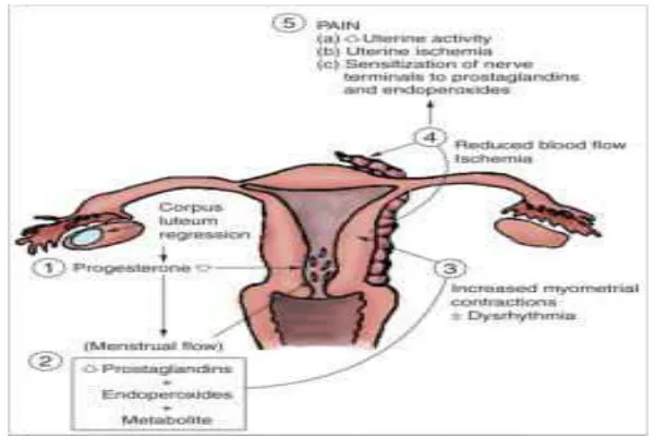 Gambar 2.1 Mekanisme yang berpengaruh dalam memicu nyeri dysmenorrhea. 
