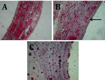 Figure 1:  Histophatologycal abdominal aorta tissue of atherosclerosis Rats. Notes: Arrows show foam cells in the sub-intima area of aorta tissue