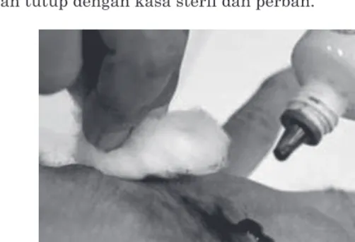 Gambar 7.10 Membersihkan luka