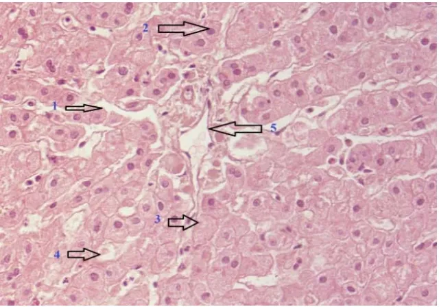 Gambar 9. Nekrosis ditandai antara lain dengan piknosis (inti sel memadat), karioreksis (inti sel pecah) dan kariolisis (inti sel lisis)