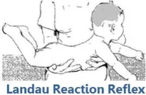 Gambar 3.5 Landau reflex 