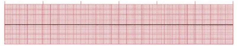 Gambar 2.3 Ritme EKG Asistole(Brunner et al., 2010) 