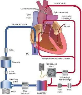 Gambar 1. Sirkuit cardiopulmonary bypass 