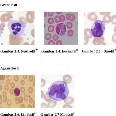 Gambar 2.1. Leukemia40                                
