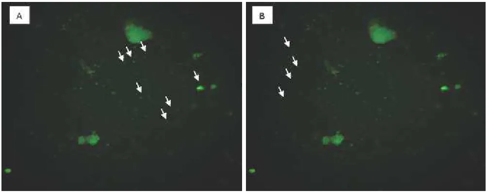 Fig. 1: Fluorescence Result of Blood Samples on 5  Day (A) Strongly Positive against CD45 Marker; th(B) Appeared Negative against CD105 Marker (200 x Magnification, Olympus Microscope CKX53, Olympus Corporation™).