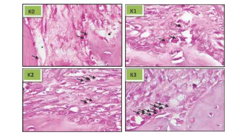 Fig. 2: Histopathology Features using HE Staining. The Number of Osteoblast in Each Group (K0, K1, K2, K3) with 1000x Magnification Using Microscope