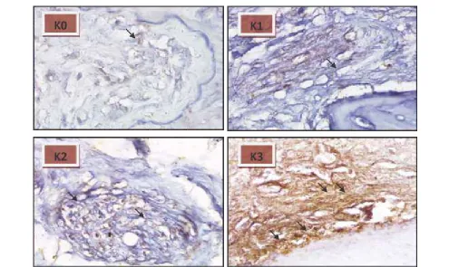 Fig. 3: OPG Expression in Each Group (K0, K1, K2, K3) with 1000x Magnification Using Microscope (IHC Staining)