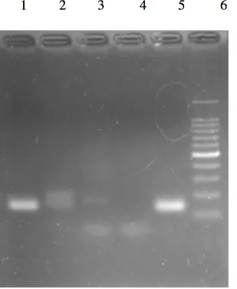 Gambar  1. Produk PCR deteksi M. leprae. Keterangan : 1: Pasien 1;  