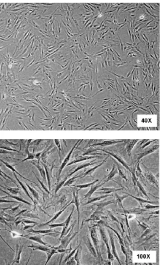Gambar 1. Karakteristik morfologi stem cell stromal jaringan adiposa in vitro, formasi sel mirip fibroblas.2  